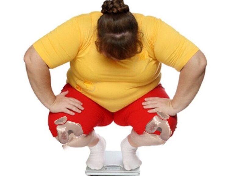 Tra i pazienti affetti da artrosi, la maggioranza è in sovrappeso o obesa