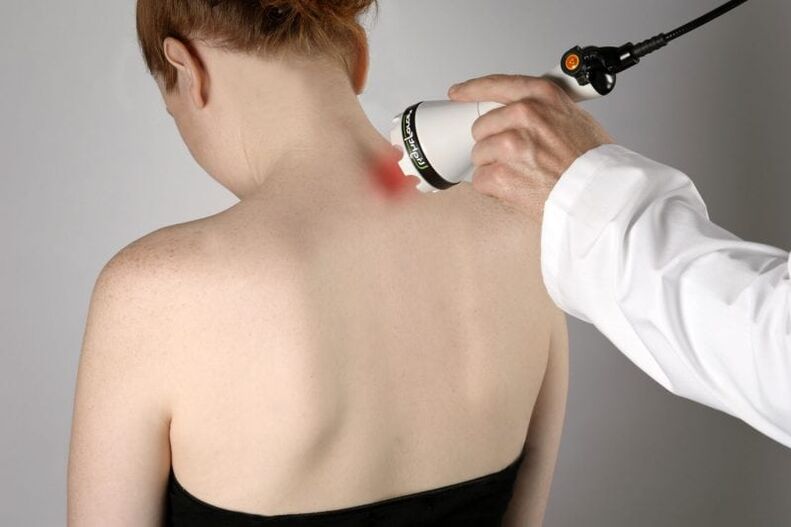 Trattamento laser dell'osteocondrosi cervicale nelle donne